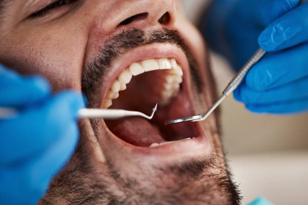 Best Dental Abscess Treatment in Nowata, OK