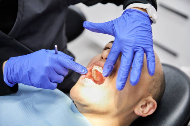 Best Knocked-Out Tooth (Avulsed Tooth) Treatment in Nowata, OK